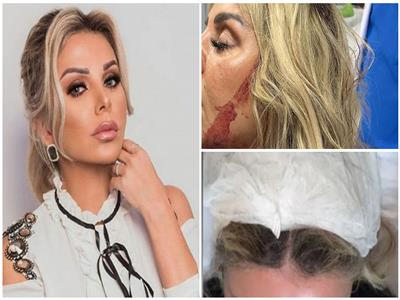 رزان مغربي تشكر محبيها بعد إصابتها نتيجة سقوط سقف فندق بالجيزة